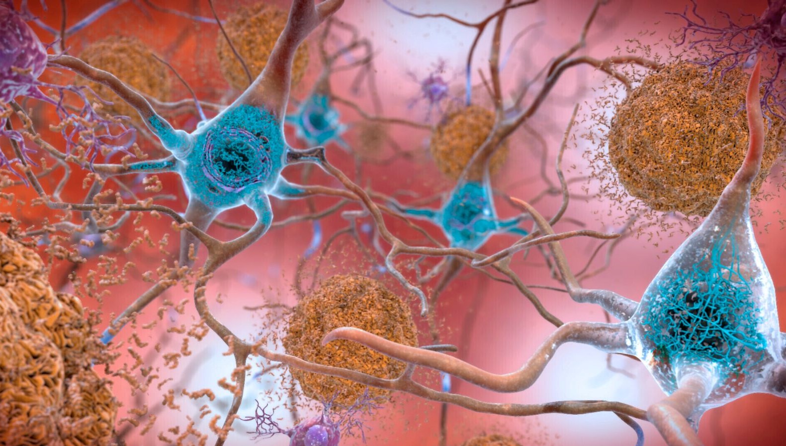 arastirmacilardan alzheimera karsi yeni yontem shield nedir qngP3SVn